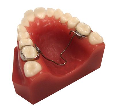 Types Of Orthodontic Appliances In Newtown & Monroe, CT | Baum Braces